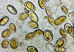 cocconeis placentula