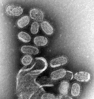 influenza-virus
