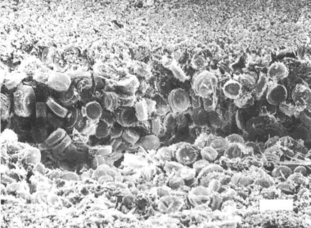 Diatom layer of varved sediments ElkLake